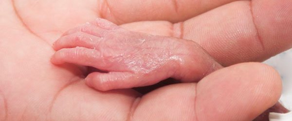 Cuidados com a pele do recém-nascido prematuro Cuidados com a pele do recém-nascido prematuro